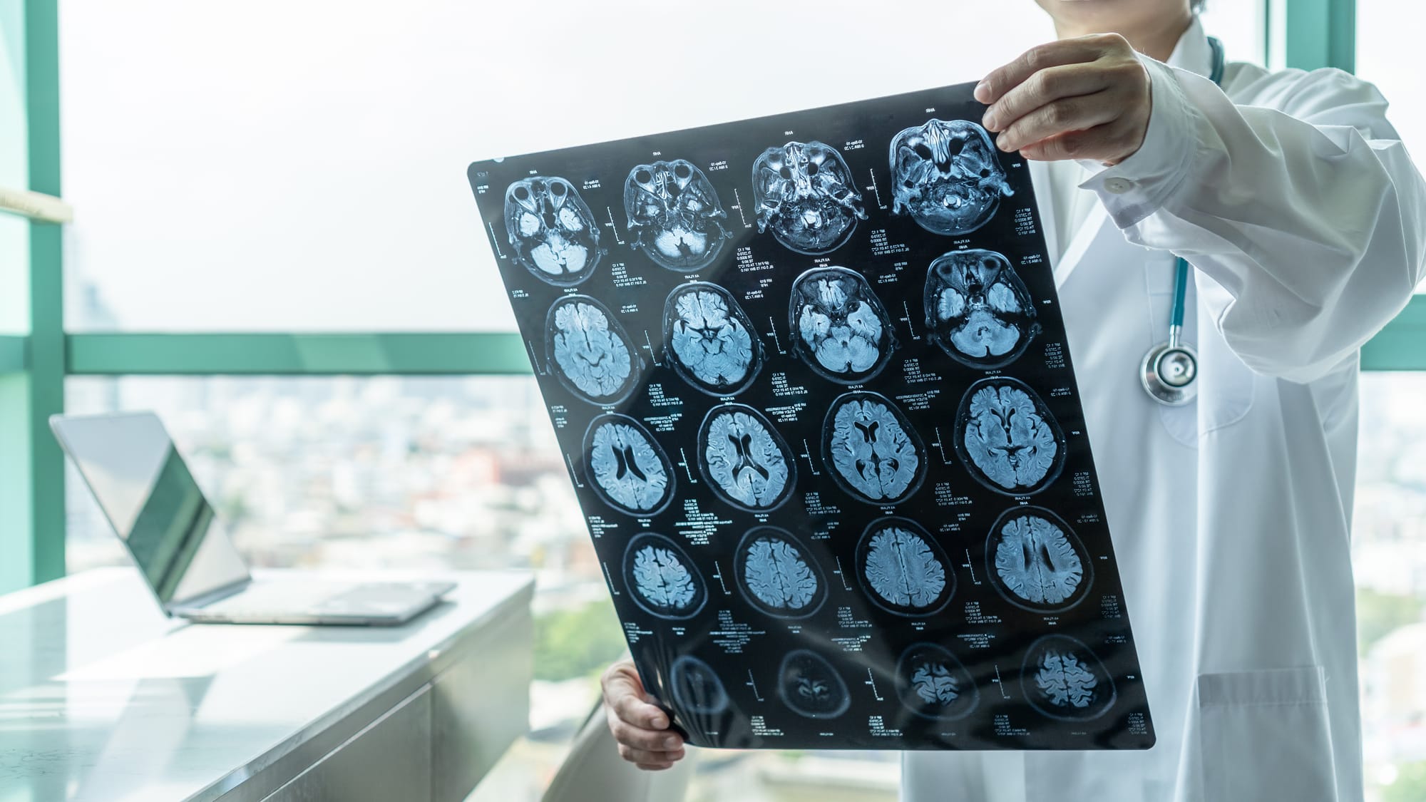 A doctor is holding a brain MRI scan in an office with a window in the background and laptop open on the desk.