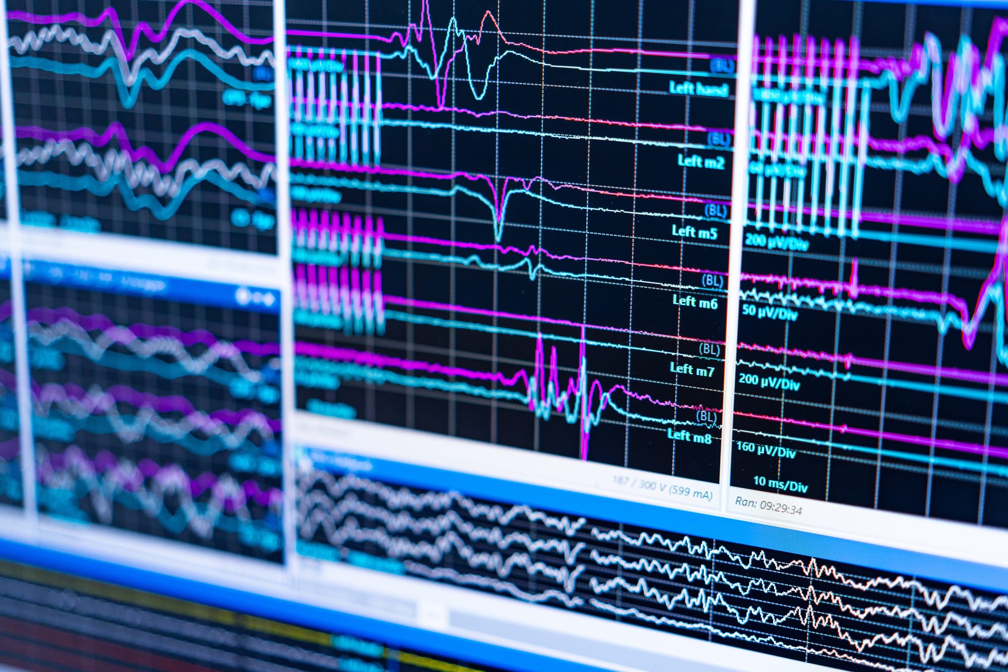 EEG brain wave testing on a computer screen.